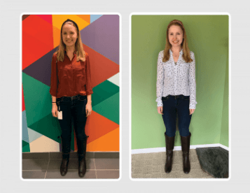 Side-by-side before and after photos showing improved upright posture and facial presence