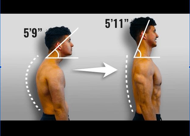 Before and after comparison showing slouched 5'9" posture versus upright 5'11" posture with angle overlays